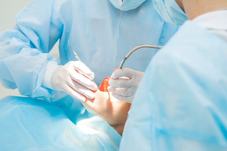 口腔外科の主な病気と治療