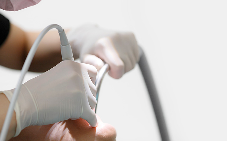 一人ひとりに合わせた予防歯科